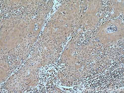 CORO2A Rabbit Polyclonal Antibody, Proteintech Unconjugated; 150 &mu;L:Antibodies,