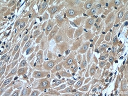 CORO2A Rabbit Polyclonal Antibody, Proteintech Unconjugated; 150 &mu;L:Antibodies,
