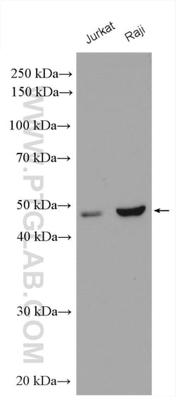 CORO2A Rabbit Polyclonal Antibody, Proteintech Unconjugated; 150 &mu;L:Antibodies,