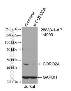 CORO2A Rabbit Polyclonal Antibody, Proteintech Unconjugated; 150 &mu;L:Antibodies,