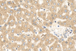 CPN2 Rabbit Polyclonal Antibody, Proteintech:Antibodies:Primary Antibodies