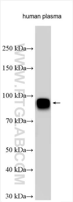 CPN2 Rabbit Polyclonal Antibody, Proteintech:Antibodies:Primary Antibodies