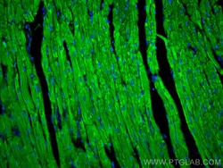 CoraLite Plus 488-conjugated CPT1B-specific Rabbit Polyclonal Antibody,