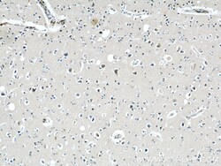 CPT1C-specific Rabbit Polyclonal Antibody, Proteintech Unconjugated; 20