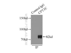 CPT1C-specific Rabbit Polyclonal Antibody, Proteintech Unconjugated; 20