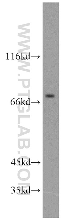 CPT1C-specific Rabbit Polyclonal Antibody, Proteintech Unconjugated; 20