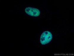 CREBBP Rabbit Polyclonal Antibody, Proteintech:Antibodies:Primary Antibodies