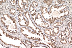 CREBBP Rabbit Polyclonal Antibody, Proteintech:Antibodies:Primary Antibodies