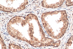 CREBBP Rabbit Polyclonal Antibody, Proteintech:Antibodies:Primary Antibodies