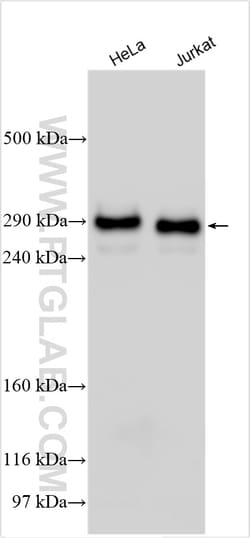 CREBBP Rabbit Polyclonal Antibody, Proteintech