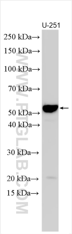 CRLF3 Rabbit Polyclonal Antibody, Proteintech:Antibodies:Primary Antibodies