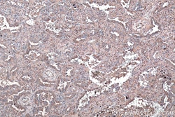 CRMP1 Mouse Monoclonal Antibody, Proteintech:Antibodies:Primary Antibodies