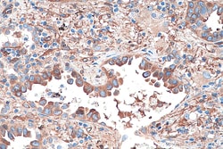 CRMP1 Mouse Monoclonal Antibody, Proteintech:Antibodies:Primary Antibodies