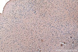 CRMP1 Mouse Monoclonal Antibody, Proteintech:Antibodies:Primary Antibodies