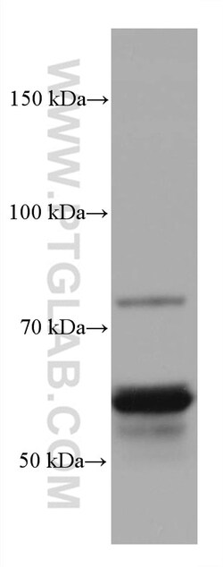 CRMP1 Mouse Monoclonal Antibody, Proteintech:Antibodies:Primary Antibodies