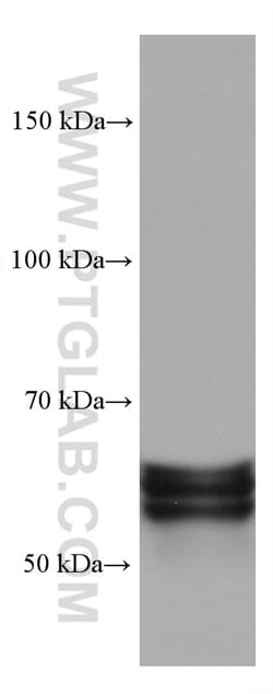 CRMP1 Mouse Monoclonal Antibody, Proteintech:Antibodies:Primary Antibodies