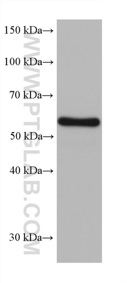 CRMP5 Mouse Monoclonal Antibody, Proteintech Unconjugated; 150 &mu;L:Antibodies,