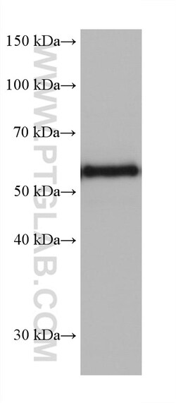 CRMP5 Mouse Monoclonal Antibody, Proteintech Unconjugated; 150 &mu;L:Antibodies,