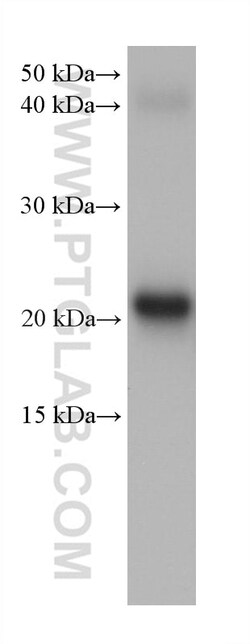 CRYBA2 Mouse Monoclonal Antibody, Proteintech 20 &mu;L | Buy Online | Proteintech | Fisher Scientific