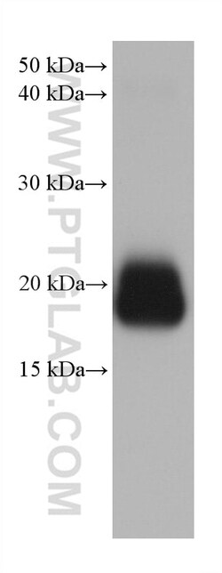 CRYBA2 Mouse Monoclonal Antibody, Proteintech 20 &mu;L | Buy Online | Proteintech | Fisher Scientific