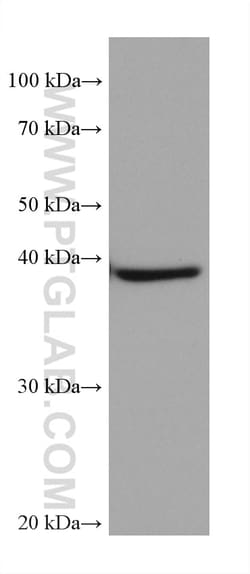 CSNK2A1 Mouse Monoclonal Antibody, Proteintech Unconjugated; 150 &mu;L:Antibodies,