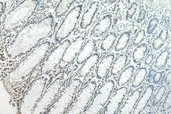CSNK2B Mouse Monoclonal Antibody, Proteintech Unconjugated; 20 &mu;L:Antibodies,