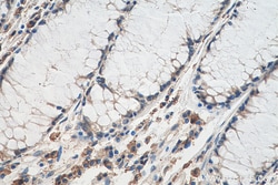 CSNK2B Mouse Monoclonal Antibody, Proteintech Unconjugated; 20 &mu;L:Antibodies,