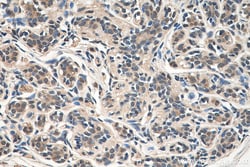 CSNK2B Mouse Monoclonal Antibody, Proteintech Unconjugated; 20 &mu;L:Antibodies,