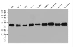 CSNK2B Mouse Monoclonal Antibody, Proteintech Unconjugated; 20 &mu;L:Antibodies,