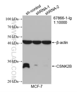 CSNK2B Mouse Monoclonal Antibody, Proteintech Unconjugated; 20 &mu;L:Antibodies,