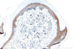 CTNNBIP1 Rabbit Polyclonal Antibody, Proteintech:Anticuerpos:Anticuerpos