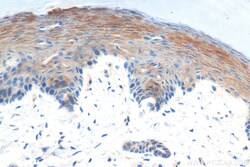 CTNNBIP1 Rabbit Polyclonal Antibody, Proteintech