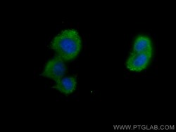 CTPS2 Mouse Monoclonal Antibody, Proteintech Unconjugated; 150 &mu;L:Antibodies,