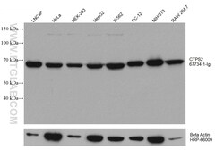 CTPS2 Mouse Monoclonal Antibody, Proteintech Unconjugated; 150 &mu;L:Antibodies,
