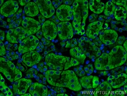 CX3CR1 Rabbit Polyclonal Antibody, Proteintech:Antibodies:Primary Antibodies