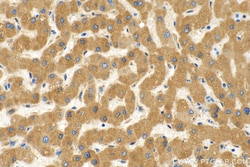 CYP2C9 Rabbit Polyclonal Antibody, Proteintech Unconjugated; 150 &mu;L:Antibodies,