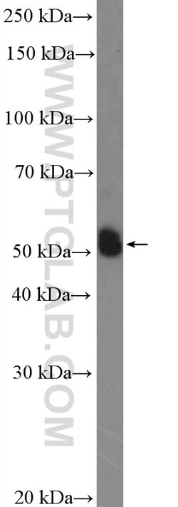 CYP2C9 Rabbit Polyclonal Antibody, Proteintech Unconjugated; 150 &mu;L:Antibodies,