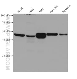 CYP2S1 Mouse Monoclonal Antibody, Proteintech Unconjugated; 150 &mu;L:Antibodies,