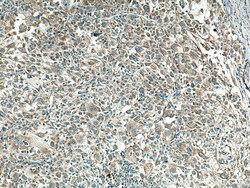 CYR61/CCN1 Mouse Monoclonal Antibody, Proteintech Unconjugated; 150 &mu;L:Antibodies,