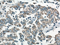 CYR61/CCN1 Mouse Monoclonal Antibody, Proteintech Unconjugated; 150 &mu;L:Antibodies,