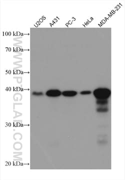 CYR61/CCN1 Mouse Monoclonal Antibody, Proteintech Unconjugated; 150 &mu;L:Antibodies,