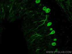 CoraLite Plus 488-conjugated Calbindin-D28k Mouse Monoclonal Antibody,