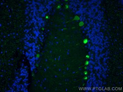 CoraLite Plus 488-conjugated Calbindin-D28k Mouse Monoclonal Antibody,