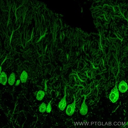 CoraLite™ Plus 488-conjugated Calbindin-D28k Mouse Monoclonal Antibody, Proteintech