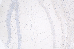 Caspase 3 Rabbit Recombinant Antibody, Proteintech Unconjugated; 100 &mu;L:Antibodies