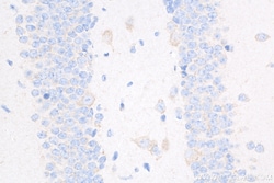 Caspase 3 Rabbit Recombinant Antibody, Proteintech Unconjugated; 100 &mu;L:Antibodies