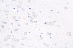 Caspase 3 Rabbit Recombinant Antibody, Proteintech Unconjugated; 100 &mu;L:Antibodies