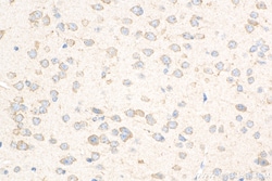 Caspase 3 Rabbit Recombinant Antibody, Proteintech Unconjugated; 100 &mu;L:Antibodies