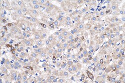 Caspase 7 Mouse Monoclonal Antibody, Proteintech Unconjugated; 150 &mu;L:Antibodies,