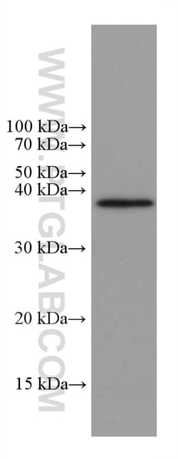 Caspase 7 Mouse Monoclonal Antibody, Proteintech Unconjugated; 150 &mu;L:Antibodies,